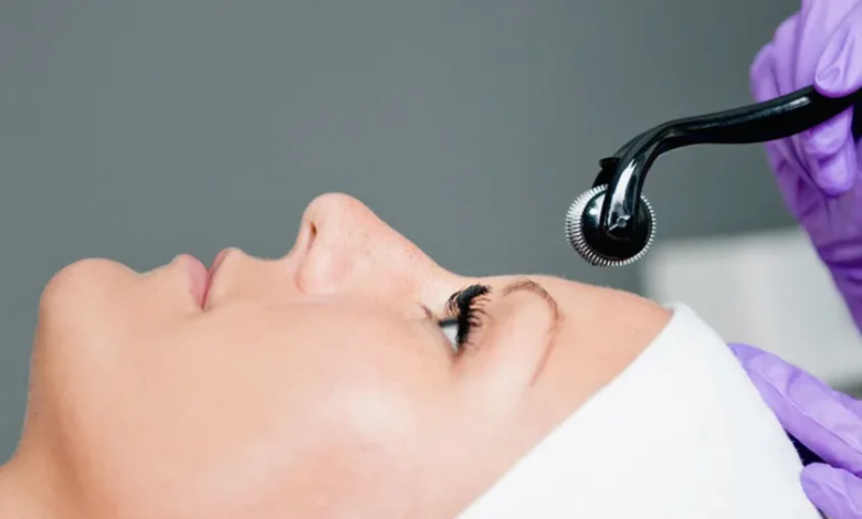 The Beginner's Guide to Collagen Induction Therapy: What You Need to Know