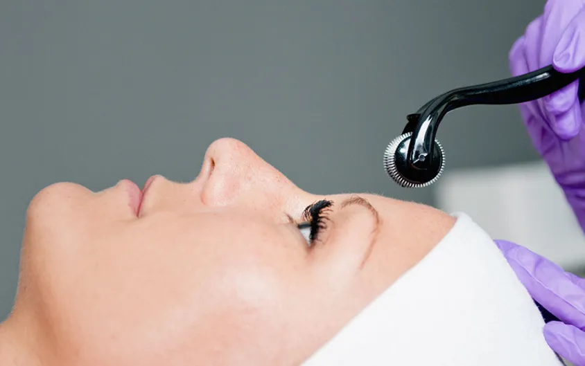 The Beginner's Guide to Collagen Induction Therapy: What You Need to Know